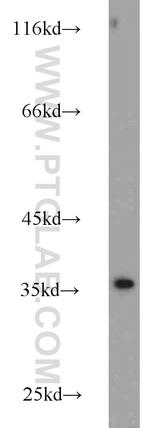Annexin V Antibody in Western Blot (WB)