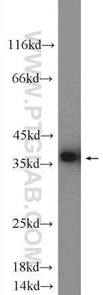Annexin V Antibody in Western Blot (WB)