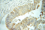 TIMM17B Antibody in Immunohistochemistry (Paraffin) (IHC (P))