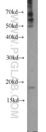TIMM17B Antibody in Western Blot (WB)