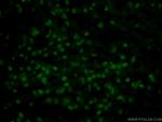 SOX2 Antibody in Immunohistochemistry (PFA fixed) (IHC (PFA))