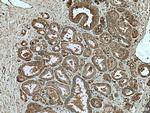 IGFBP2 Antibody in Immunohistochemistry (Paraffin) (IHC (P))