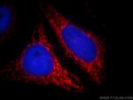 ABCB9 Antibody in Immunocytochemistry (ICC/IF)