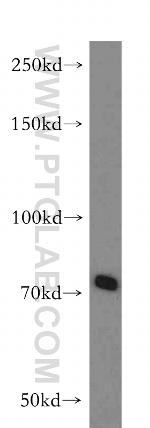 ABCB9 Antibody in Western Blot (WB)