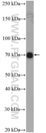 ABCB9 Antibody in Western Blot (WB)
