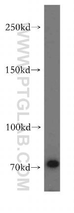 ABCB9 Antibody in Western Blot (WB)