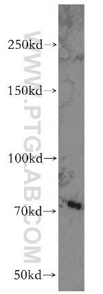ABCB9 Antibody in Western Blot (WB)