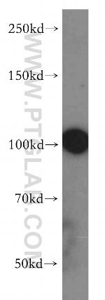 ABCB9 Antibody in Western Blot (WB)