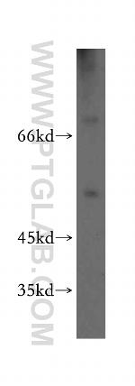 ABCB9 Antibody in Western Blot (WB)