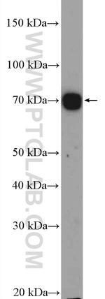 ABCB9 Antibody in Western Blot (WB)