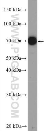 ABCB9 Antibody in Western Blot (WB)