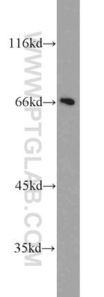FMR1NB Antibody in Western Blot (WB)