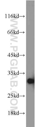 SNRPN Antibody in Western Blot (WB)