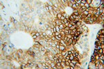 CA9 Antibody in Immunohistochemistry (Paraffin) (IHC (P))