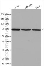 CA9 Antibody in Western Blot (WB)