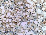 CA9 Antibody in Immunohistochemistry (Paraffin) (IHC (P))