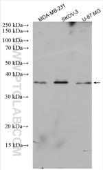 LUZP4 Antibody in Western Blot (WB)