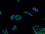 BORIS Antibody in Immunocytochemistry (ICC/IF)