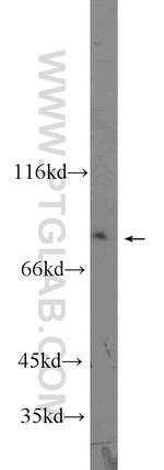 BORIS Antibody in Western Blot (WB)