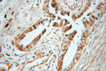 BORIS Antibody in Immunohistochemistry (Paraffin) (IHC (P))