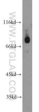 BORIS Antibody in Western Blot (WB)