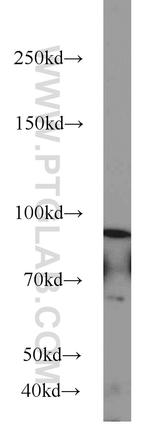 Oligophrenin 1 Antibody in Western Blot (WB)