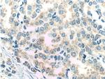 RDH11 Antibody in Immunohistochemistry (Paraffin) (IHC (P))
