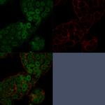 CHD4 Monoclonal Antibody (3F2/4)