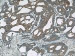 UCP2 Antibody in Immunohistochemistry (Paraffin) (IHC (P))
