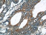 UCP2 Antibody in Immunohistochemistry (Paraffin) (IHC (P))