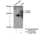 UCP2 Antibody in Immunoprecipitation (IP)