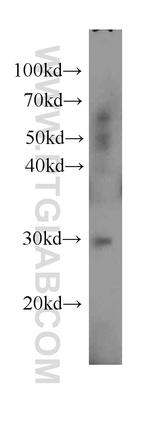 UCP2 Antibody in Western Blot (WB)