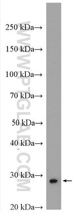 UCP2 Antibody in Western Blot (WB)