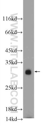 UCP2 Antibody in Western Blot (WB)