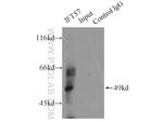 IFT57 Antibody in Immunoprecipitation (IP)