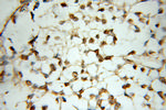 POLR3K Antibody in Immunohistochemistry (Paraffin) (IHC (P))