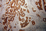 PARD3 Antibody in Immunohistochemistry (Paraffin) (IHC (P))