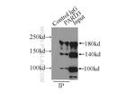 PARD3 Antibody in Immunoprecipitation (IP)
