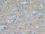 IRSp53 Antibody in Immunohistochemistry (Paraffin) (IHC (P))