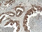 CCDC5 Antibody in Immunohistochemistry (Paraffin) (IHC (P))