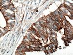 CCDC5 Antibody in Immunohistochemistry (Paraffin) (IHC (P))