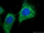 SRC Antibody in Immunocytochemistry (ICC/IF)