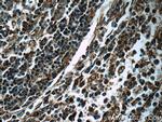 SRC Antibody in Immunohistochemistry (Paraffin) (IHC (P))