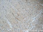 SRC Antibody in Immunohistochemistry (Paraffin) (IHC (P))