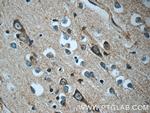 SRC Antibody in Immunohistochemistry (Paraffin) (IHC (P))