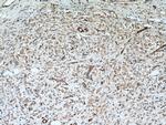SRC Antibody in Immunohistochemistry (Paraffin) (IHC (P))