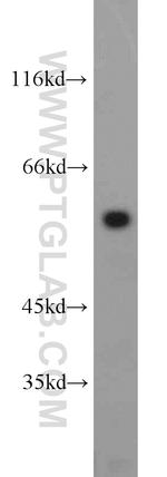SRC Antibody in Western Blot (WB)