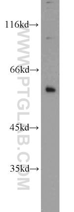 SRC Antibody in Western Blot (WB)