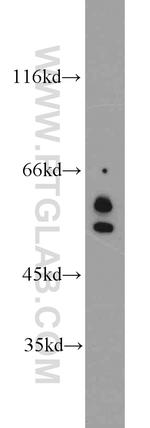 SRC Antibody in Western Blot (WB)