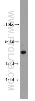 SRC Antibody in Western Blot (WB)